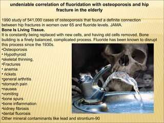 undeniable correlation of fluoridation with osteoporosis and hip
fracture in the elderly
1990 study of 541,000 cases of osteoporosis that found a definite connection
between hip fractures in women over 65 and fluoride levels. JAMA.
Bone Is Living Tissue.
It is constantly being replaced with new cells, and having old cells removed. Bone
building is a finely balanced, complicated process. Fluoride has been known to disrupt
this process since the 1930s.
•Osteoporosis
• Hypothyroid
•skeletal thinning,
•Fractures
• anemia
• rickets
•general arthritis
•stomach pain
•nausea
•vomiting
•bone spurs
•bone inflammation
•kidney fibrosis
•dental fluorosis
Other mineral contaminants like lead and strontium-90
 