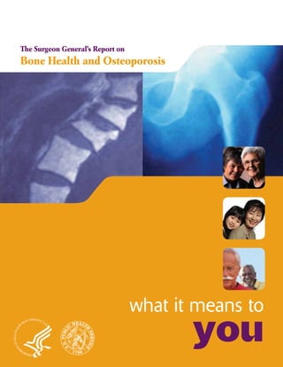 The Surgeon General’s Report on

Bone Health and Osteoporosis

what it means to

you

 