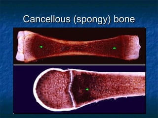 Cancellous (spongy) boneCancellous (spongy) bone
 