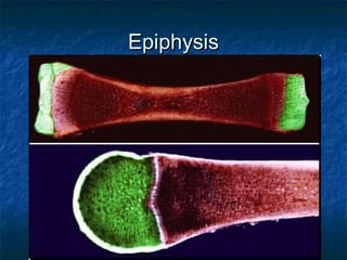 EpiphysisEpiphysis
 