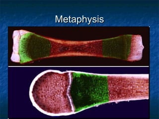 MetaphysisMetaphysis
 