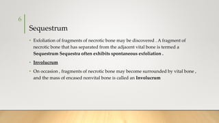 Sequestrum
• Exfoliation of fragments of necrotic bone may be discovered . A fragment of
necrotic bone that has separated from the adjacent vital bone is termed a
Sequestrum Sequestra often exhibits spontaneous exfoliation .
• Involucrum
• On occasion , fragments of necrotic bone may become surrounded by vital bone ,
and the mass of encased nonvital bone is called an Involucrum
6
 