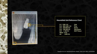 Pauwels R et al. Dentomaxillofac Radiol. 2015 Jan; 44(1): 20140238.
 