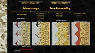 Contact
Hematoma
DAMAGED BONE
Intact bone
Implant
Callus Border bone Pseudo arthrosis
 