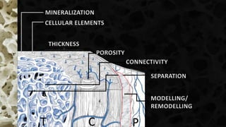 T C P
THICKNESS
POROSITY
CONNECTIVITY
SEPARATION
MINERALIZATION
CELLULAR ELEMENTS
MODELLING/
REMODELLING
 