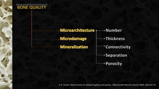 Number
Thickness
Connectivity
Separation
Porosity
C.H. Turner: Determinants of skeletal fragility and quality. J Musculoskel Neuron Interact 2002; 2(6):527-52
 