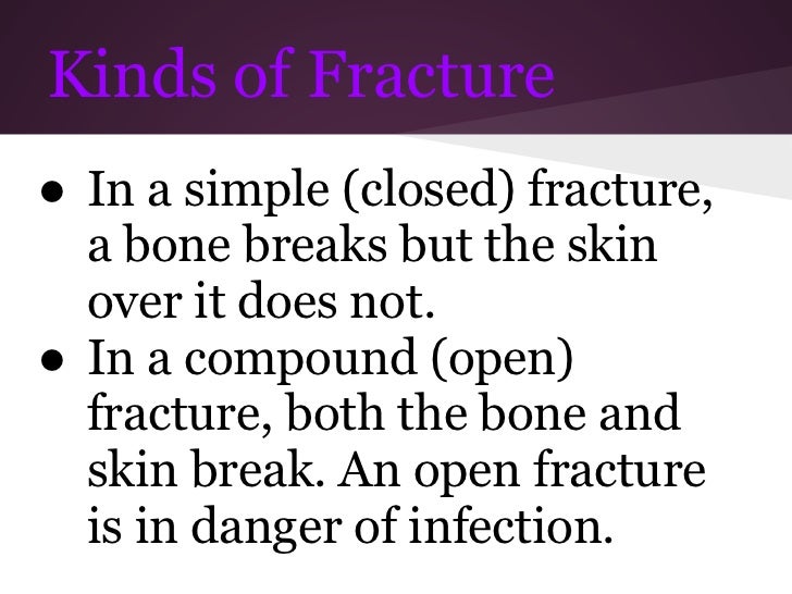 Bone fracture vs break galmyte