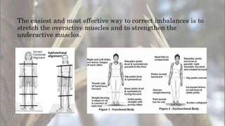 The easiest and most effective way to correct imbalances is to
stretch the overactive muscles and to strengthen the
underactive muscles.
 
