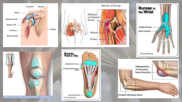Bone injuries