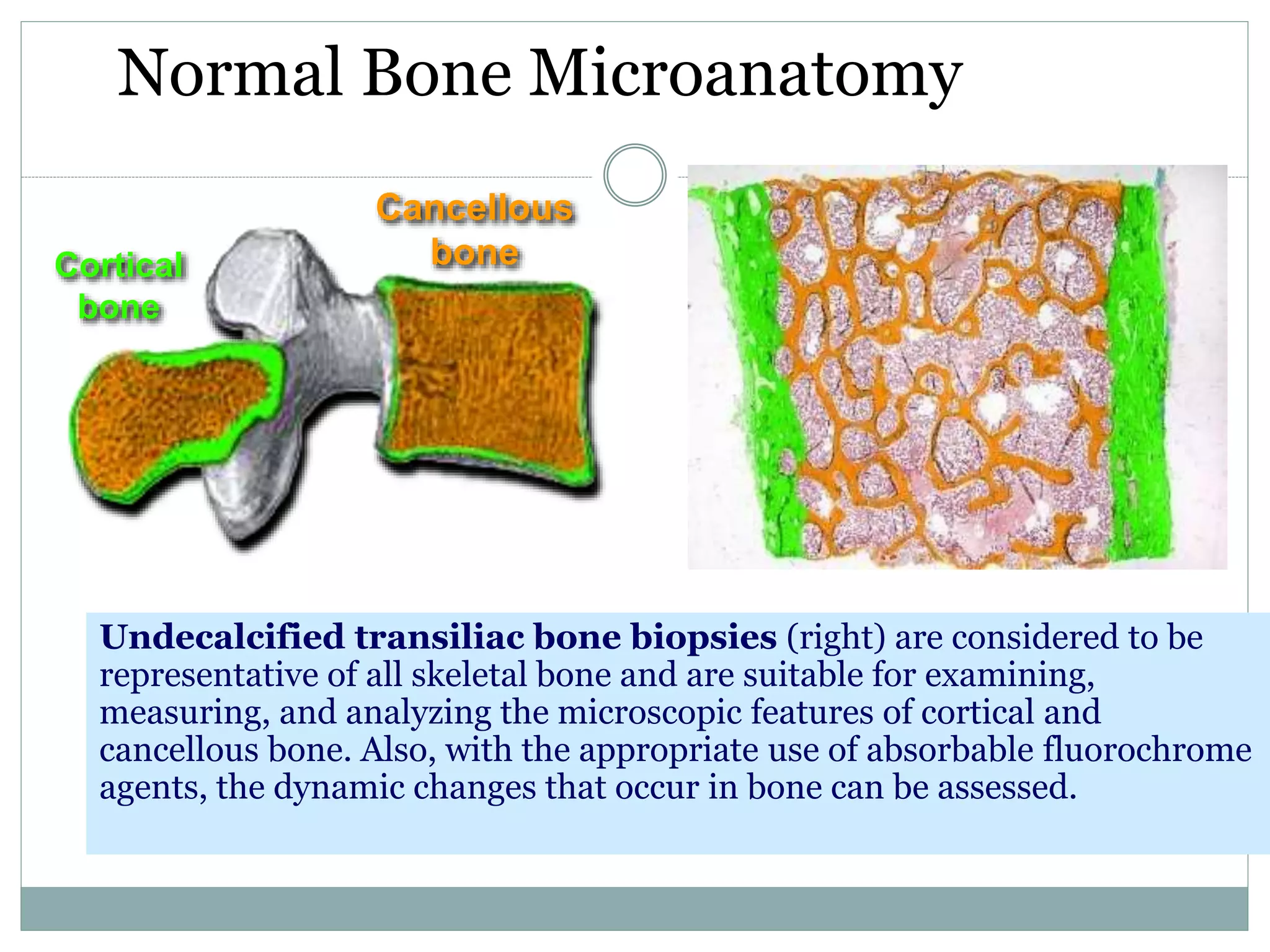 Normal Bone Microanatomy
Undecalcified transiliac bone biopsies (right) are considered to be
representative of all skeletal bone and are suitable for examining,
measuring, and analyzing the microscopic features of cortical and
cancellous bone. Also, with the appropriate use of absorbable fluorochrome
agents, the dynamic changes that occur in bone can be assessed.
Cortical
bone
Cancellous
bone
 