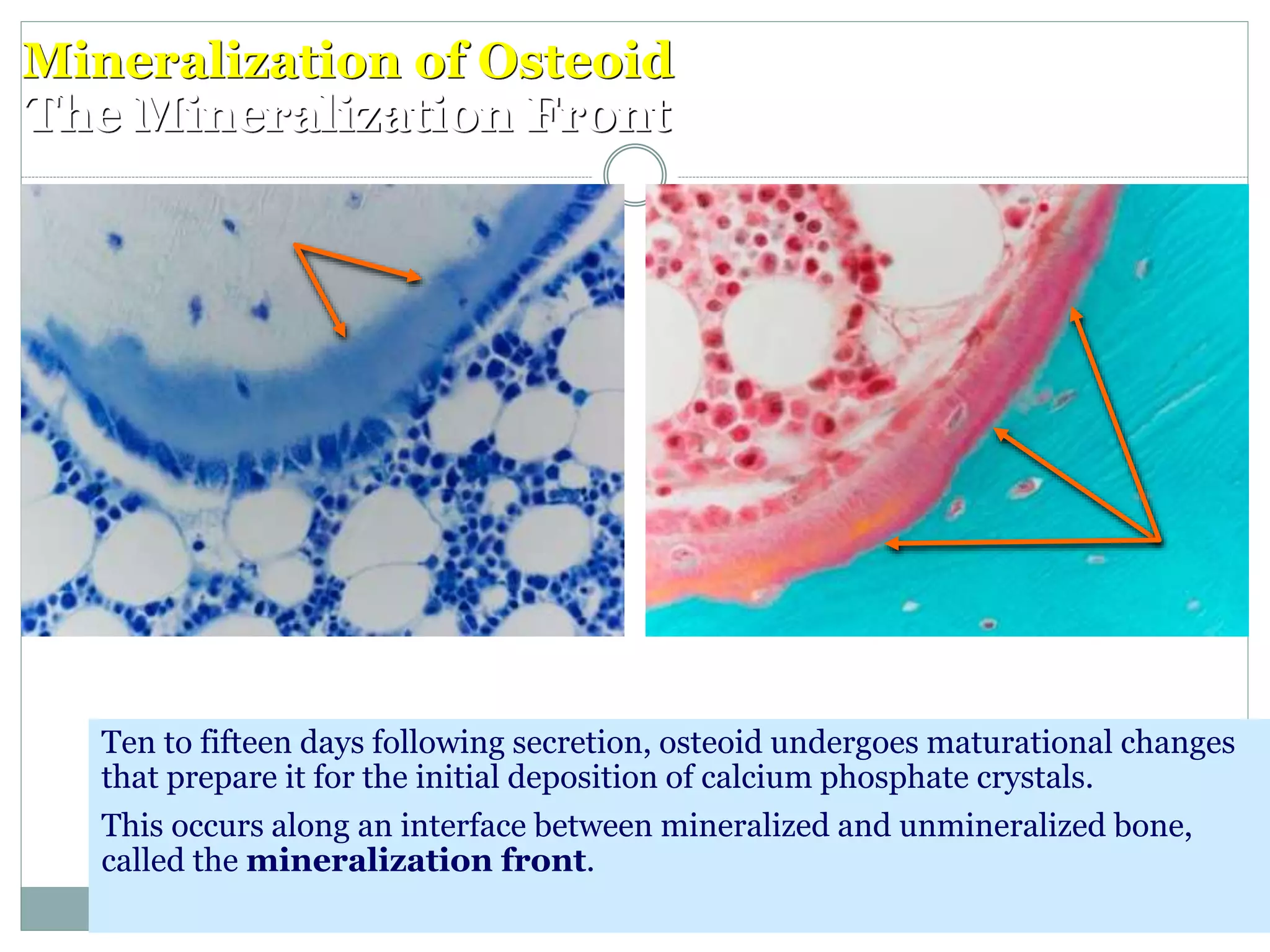 Mineralization of Osteoid
The Mineralization Front
Ten to fifteen days following secretion, osteoid undergoes maturational changes
that prepare it for the initial deposition of calcium phosphate crystals.
This occurs along an interface between mineralized and unmineralized bone,
called the mineralization front.
 