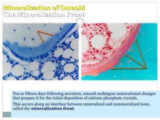 Mineralization of Osteoid
The Mineralization Front
Ten to fifteen days following secretion, osteoid undergoes maturational changes
that prepare it for the initial deposition of calcium phosphate crystals.
This occurs along an interface between mineralized and unmineralized bone,
called the mineralization front.
 