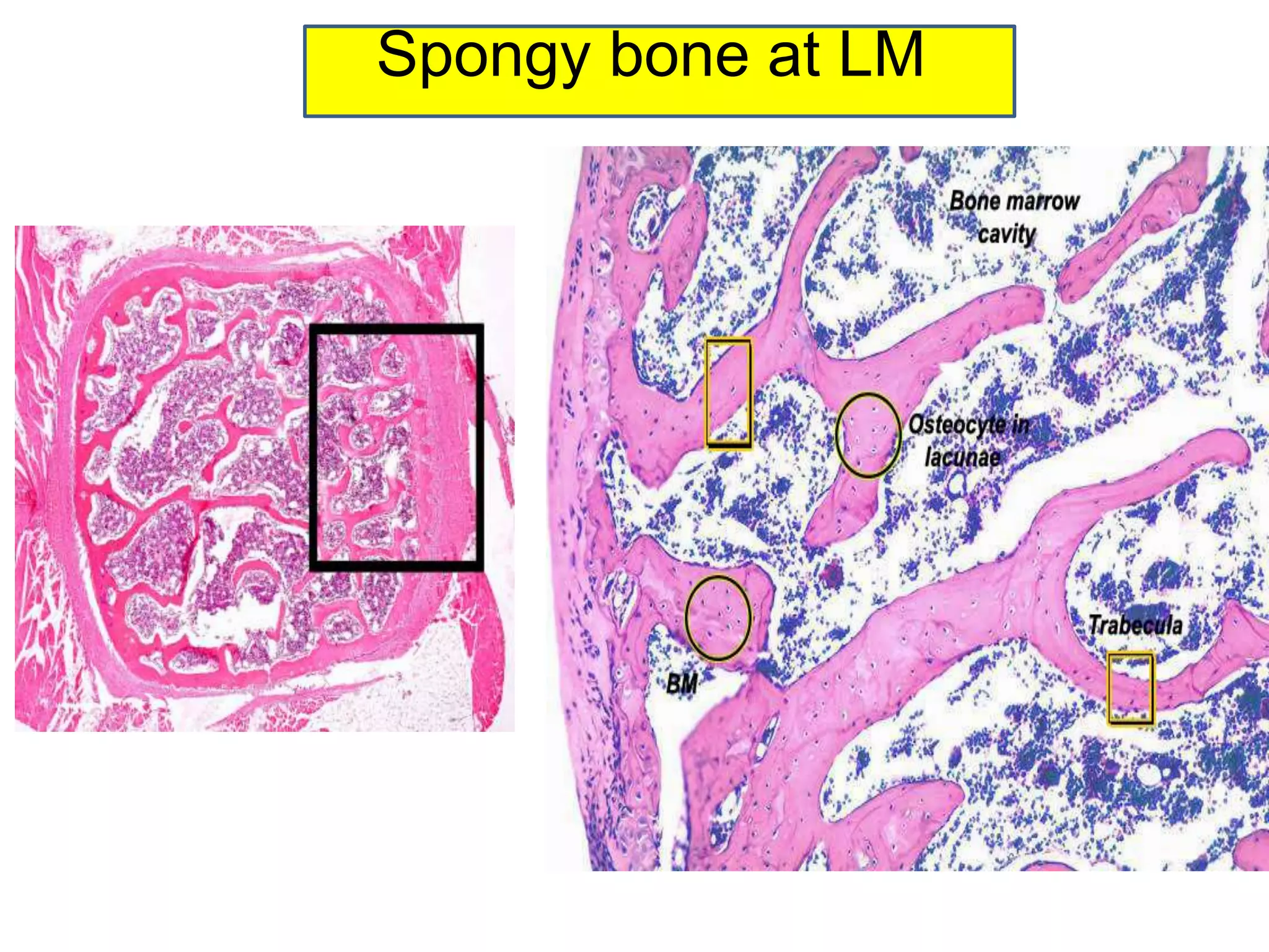 Spongy bone at LM