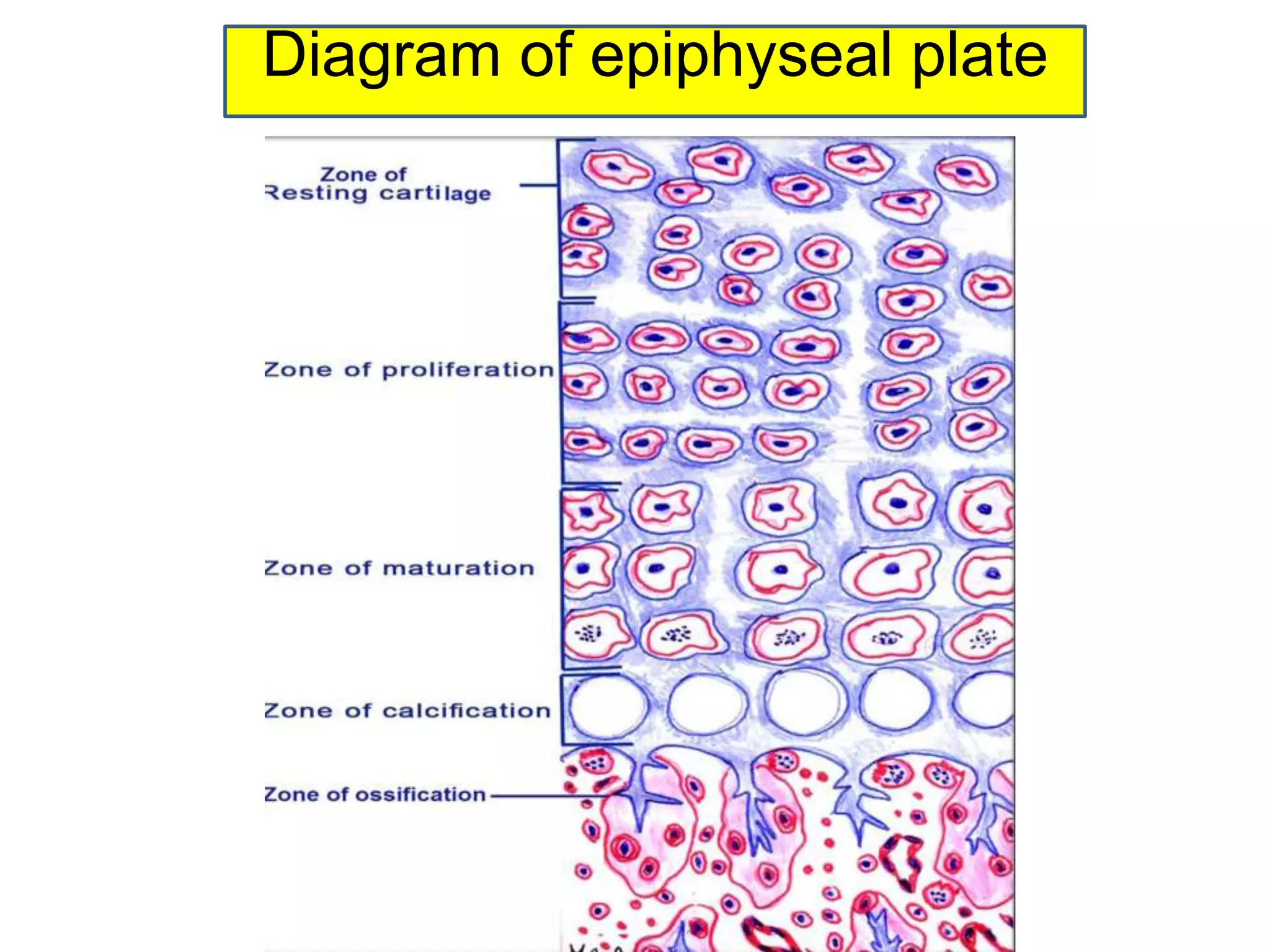 Diagram of epiphyseal plate