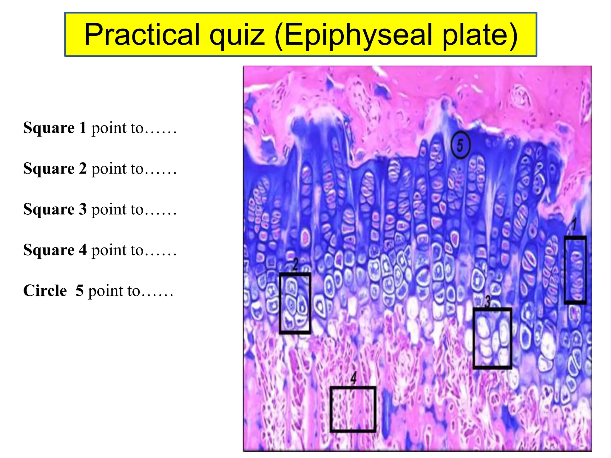 Practical quiz (Epiphyseal plate)
Square 1 point to……
Square 2 point to……
Square 3 point to……
Square 4 point to……
Circle 5 point to……