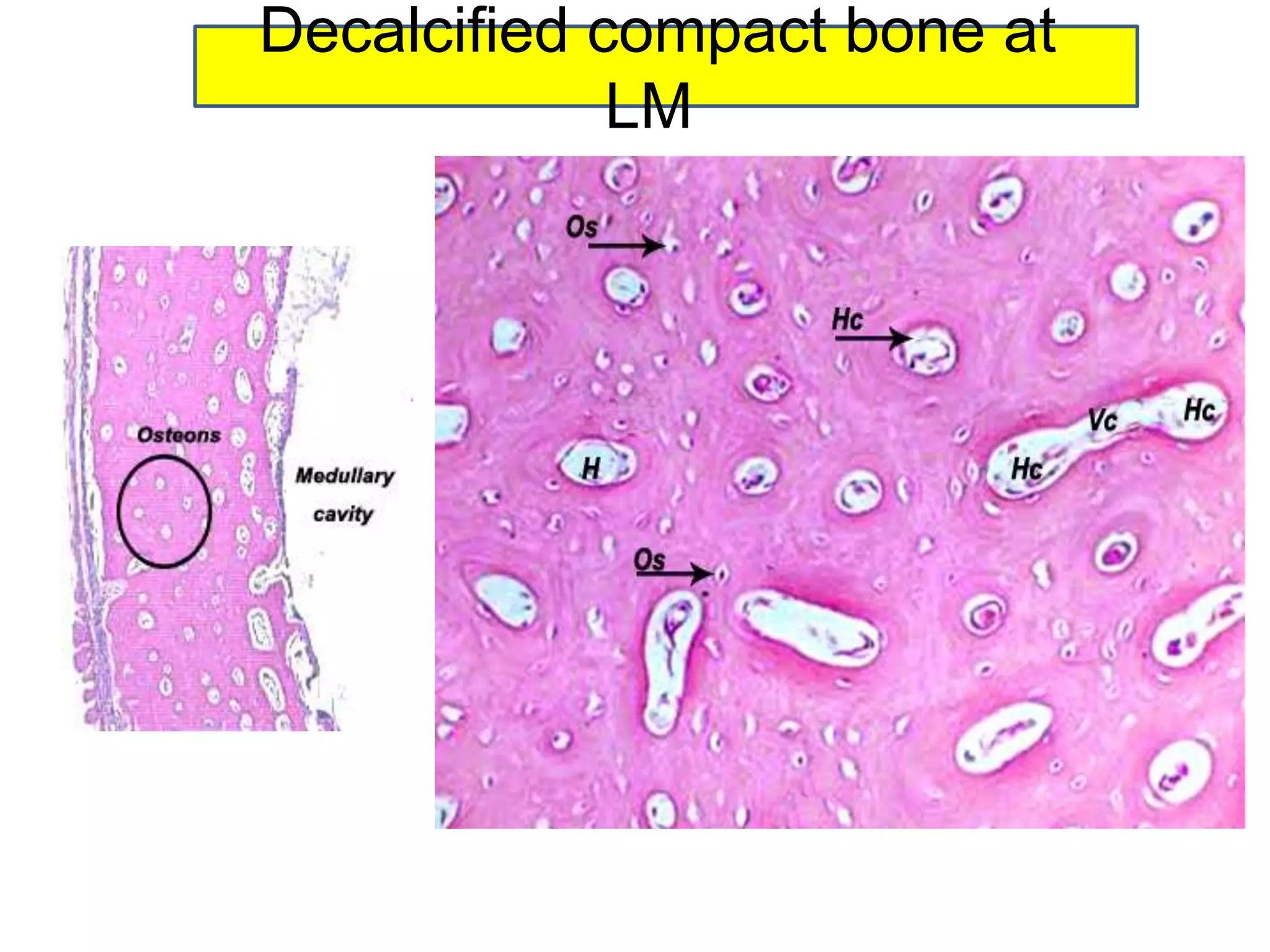 Decalcified compact bone at
LM
