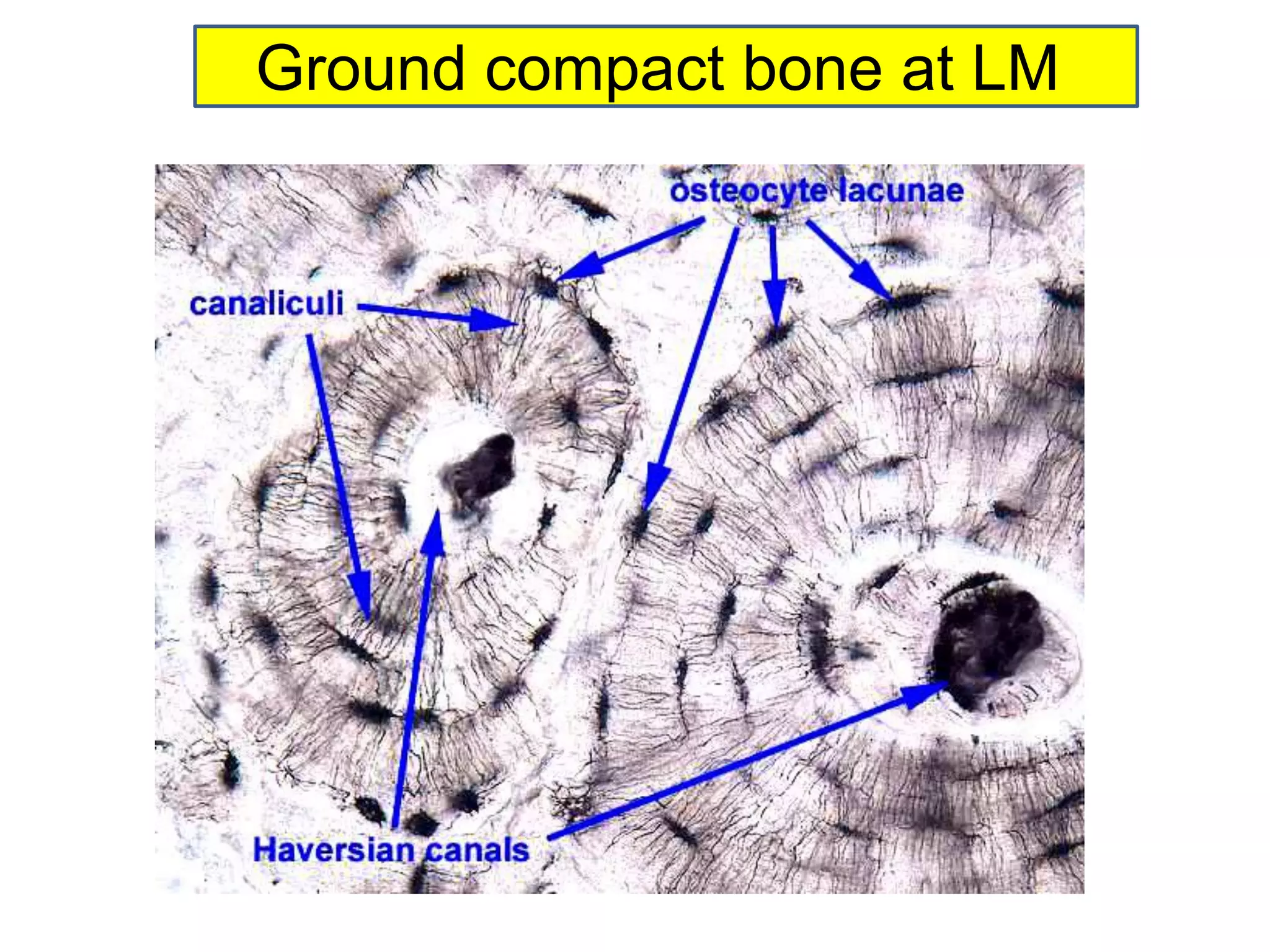 Ground compact bone at LM