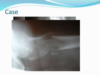 Case
 