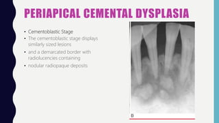 Bone Lesions Oral Pathology Pptx