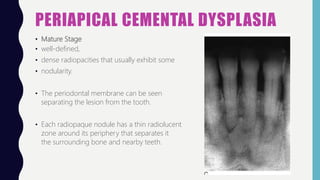 Bone Lesions Oral Pathology | PPT