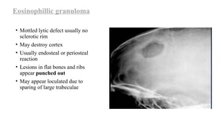 Mottling Defect Bone lesions.pptx radiology approach easy way | PPTX