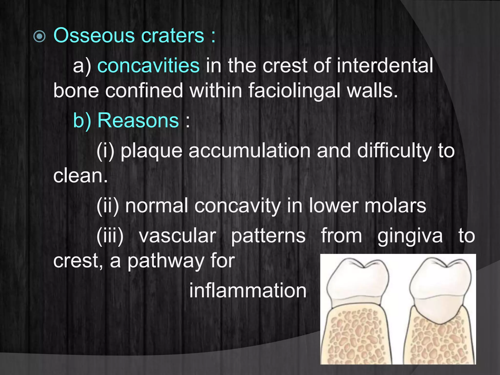  Osseous craters :
a) concavities in the crest of interdental
bone confined within faciolingal walls.
b) Reasons :
(i) plaque accumulation and difficulty to
clean.
(ii) normal concavity in lower molars
(iii) vascular patterns from gingiva to
crest, a pathway for
inflammation
 