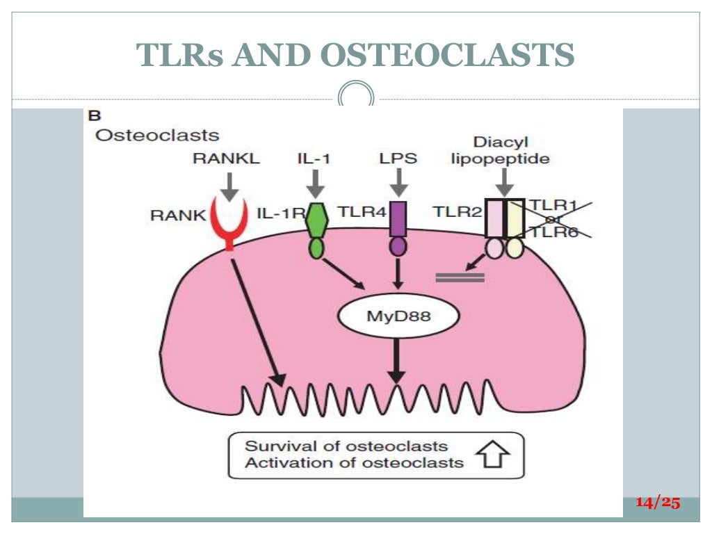 Bone loss thesis picture
