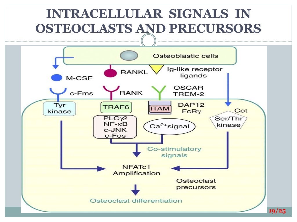 Bone loss thesis 06 image