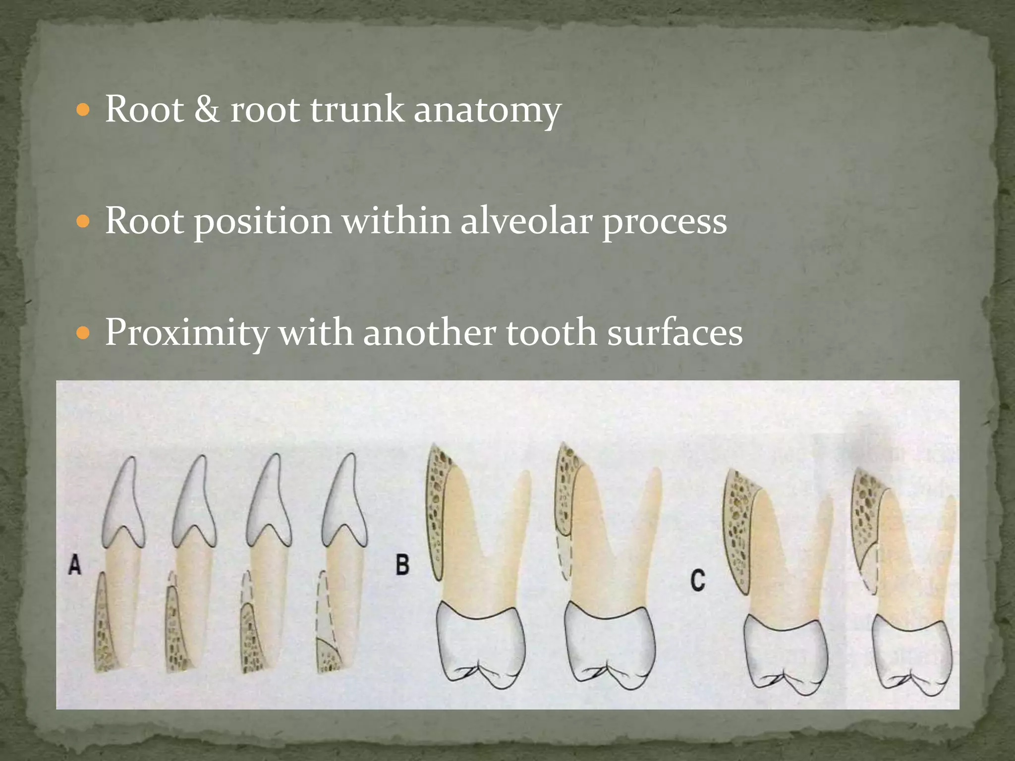  Root & root trunk anatomy
 Root position within alveolar process
 Proximity with another tooth surfaces
 