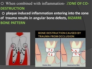 boneloss and patterns of bone destruction-190216140747.pptx