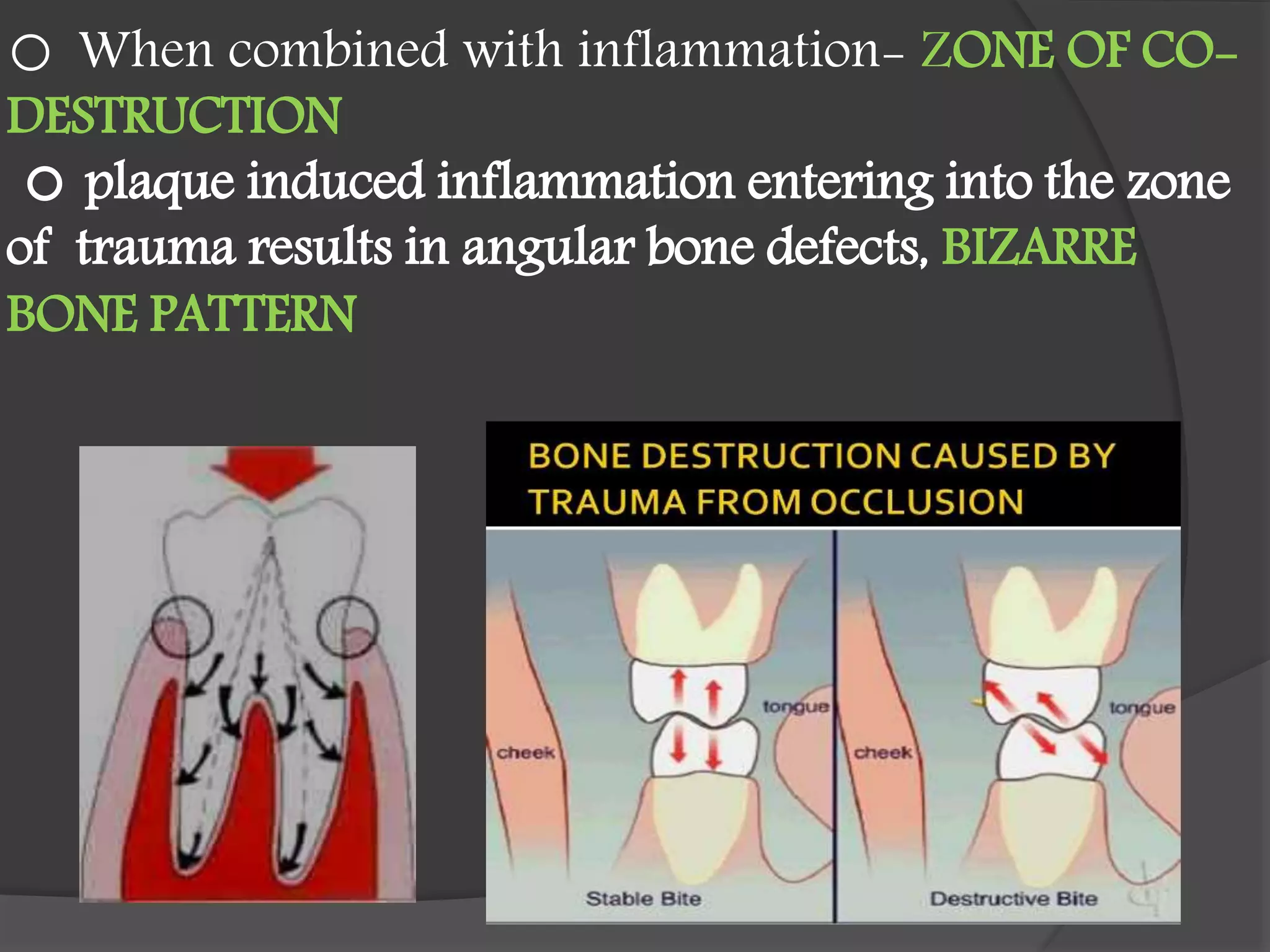 o When combined with inflammation- ZONE OF CO-
DESTRUCTION
plaque induced inflammation entering into the zone
of trauma results in angular bone defects, BIZARRE
BONE PATTERN
 