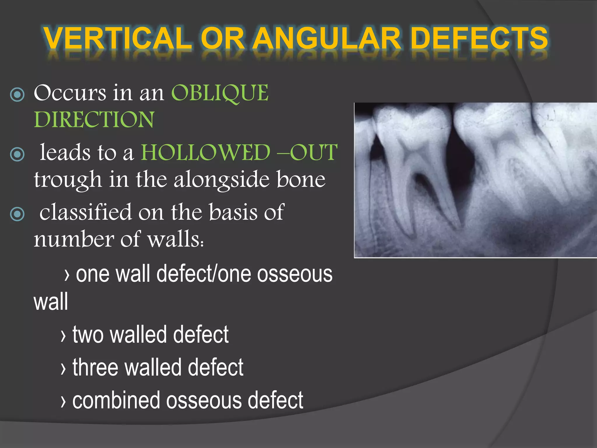 VERTICAL OR ANGULAR DEFECTS
 Occurs in an OBLIQUE
DIRECTION
 leads to a HOLLOWED –OUT
trough in the alongside bone
 classified on the basis of
number of walls:
› one wall defect/one osseous
wall
› two walled defect
› three walled defect
› combined osseous defect
 