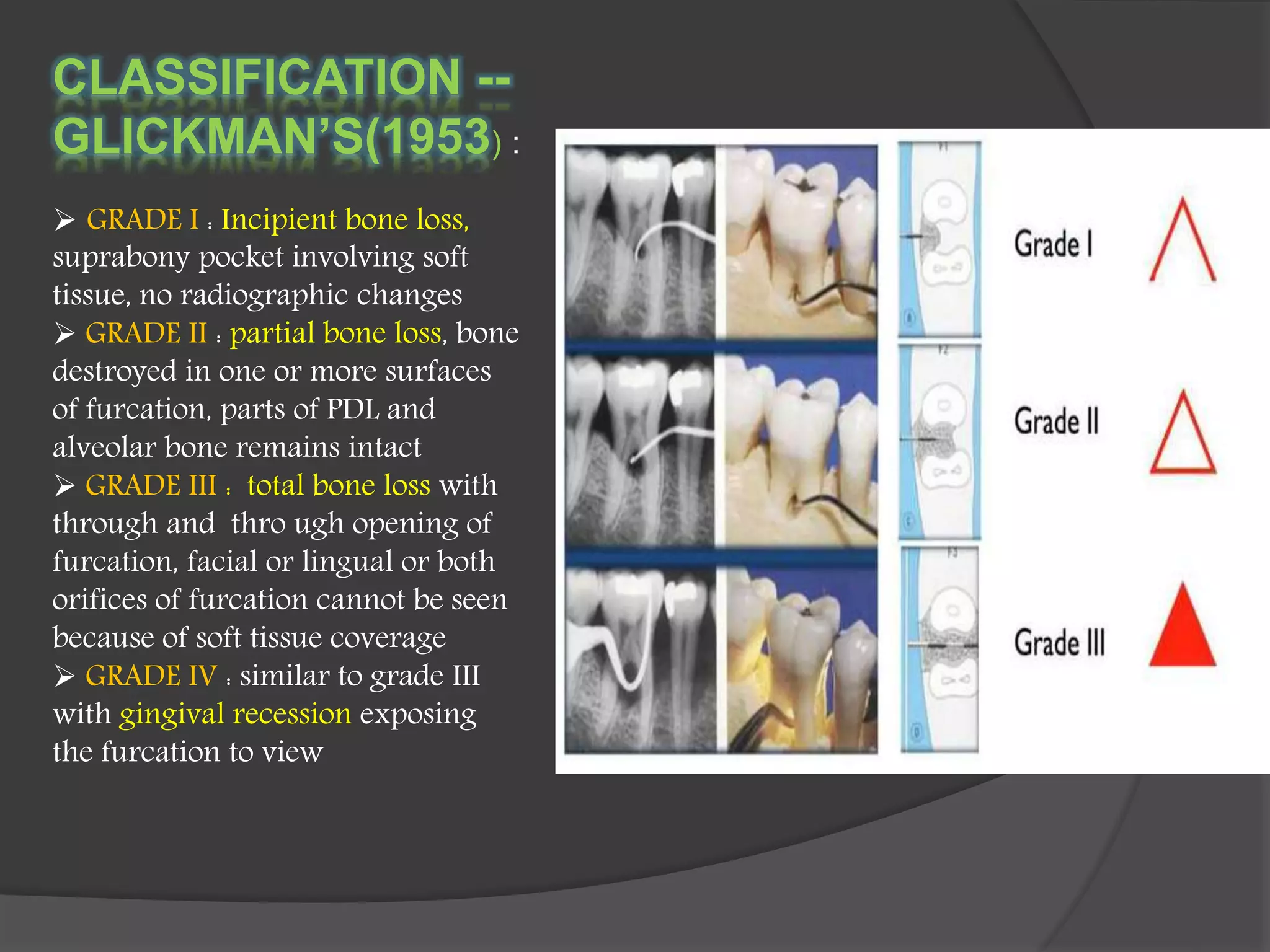CLASSIFICATION --
GLICKMAN’S(1953) :
 GRADE I : Incipient bone loss,
suprabony pocket involving soft
tissue, no radiographic changes
 GRADE II : partial bone loss, bone
destroyed in one or more surfaces
of furcation, parts of PDL and
alveolar bone remains intact
 GRADE III : total bone loss with
through and thro ugh opening of
furcation, facial or lingual or both
orifices of furcation cannot be seen
because of soft tissue coverage
 GRADE IV : similar to grade III
with gingival recession exposing
the furcation to view
 