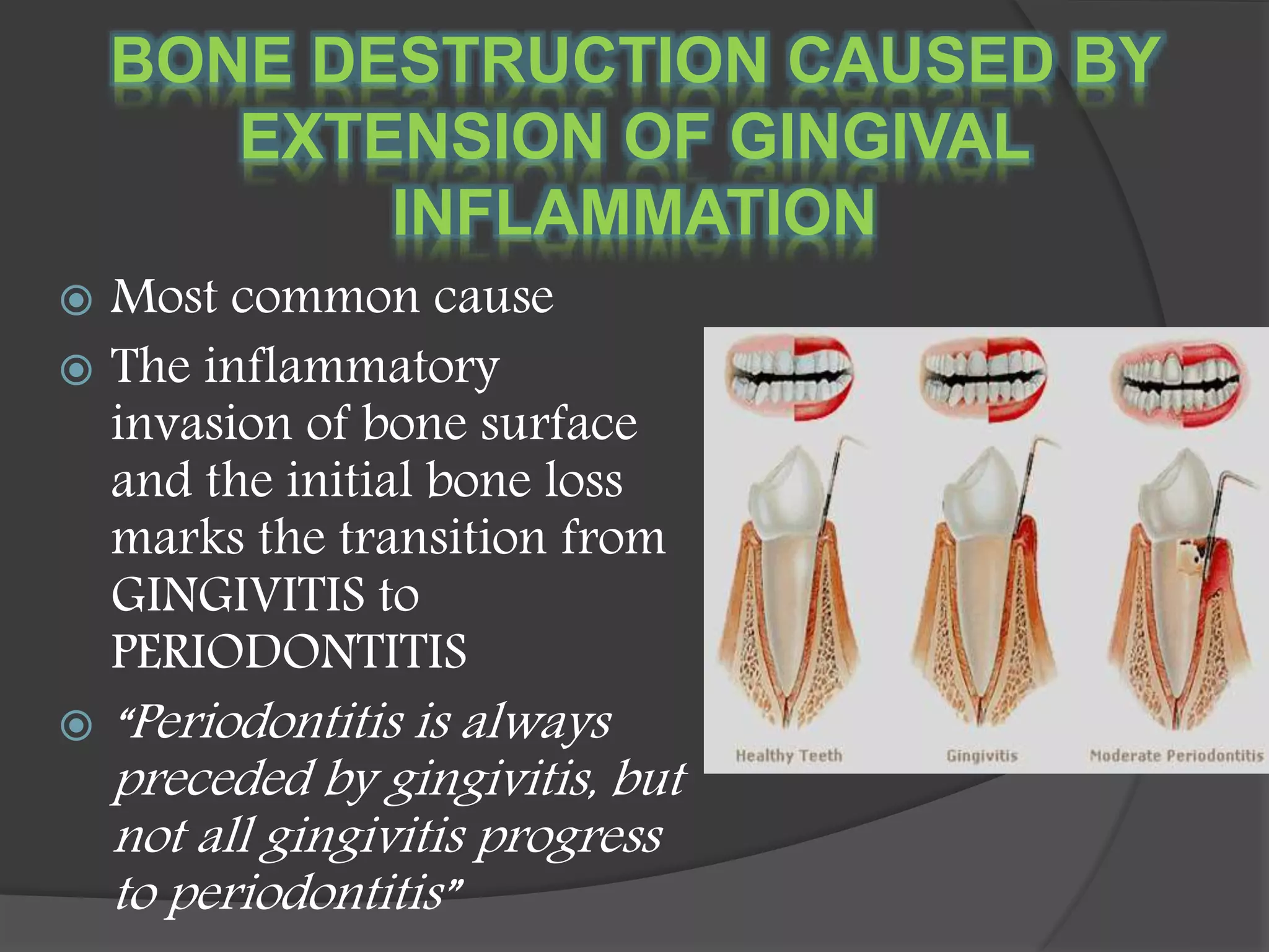 BONE DESTRUCTION CAUSED BY
EXTENSION OF GINGIVAL
INFLAMMATION
 Most common cause
 The inflammatory
invasion of bone surface
and the initial bone loss
marks the transition from
GINGIVITIS to
PERIODONTITIS
 “Periodontitis is always
preceded by gingivitis, but
not all gingivitis progress
to periodontitis”
 