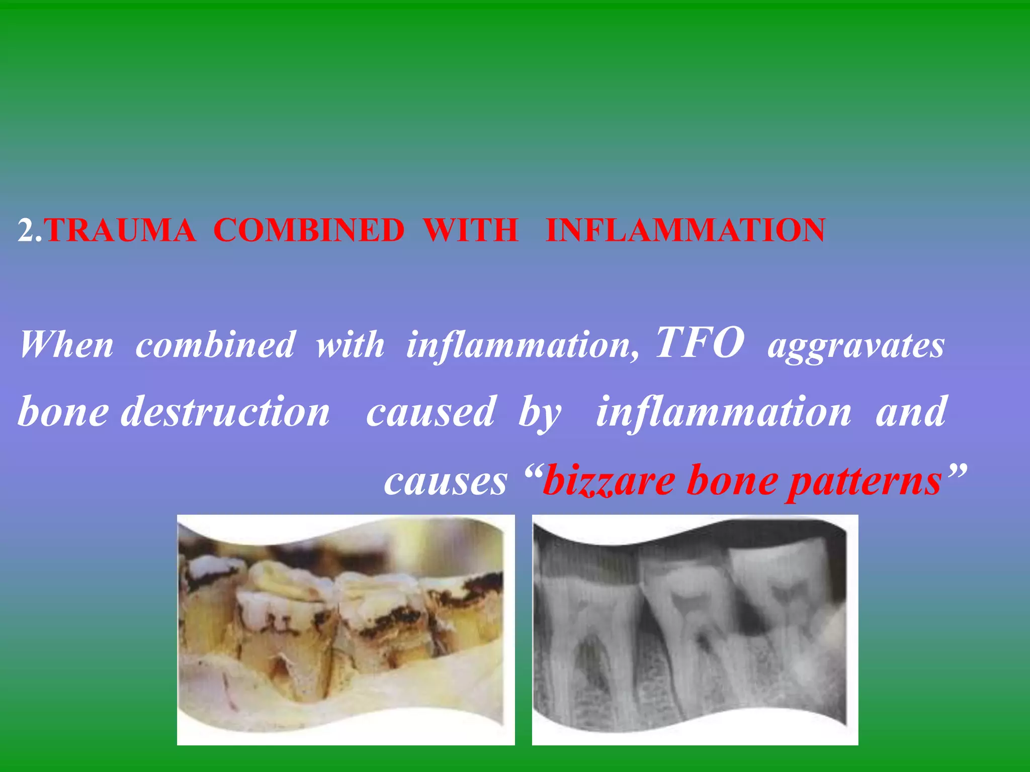 2.TRAUMA COMBINED WITH INFLAMMATION
When combined with inflammation, TFO aggravates
bone destruction caused by inflammation and
causes “bizzare bone patterns”
 