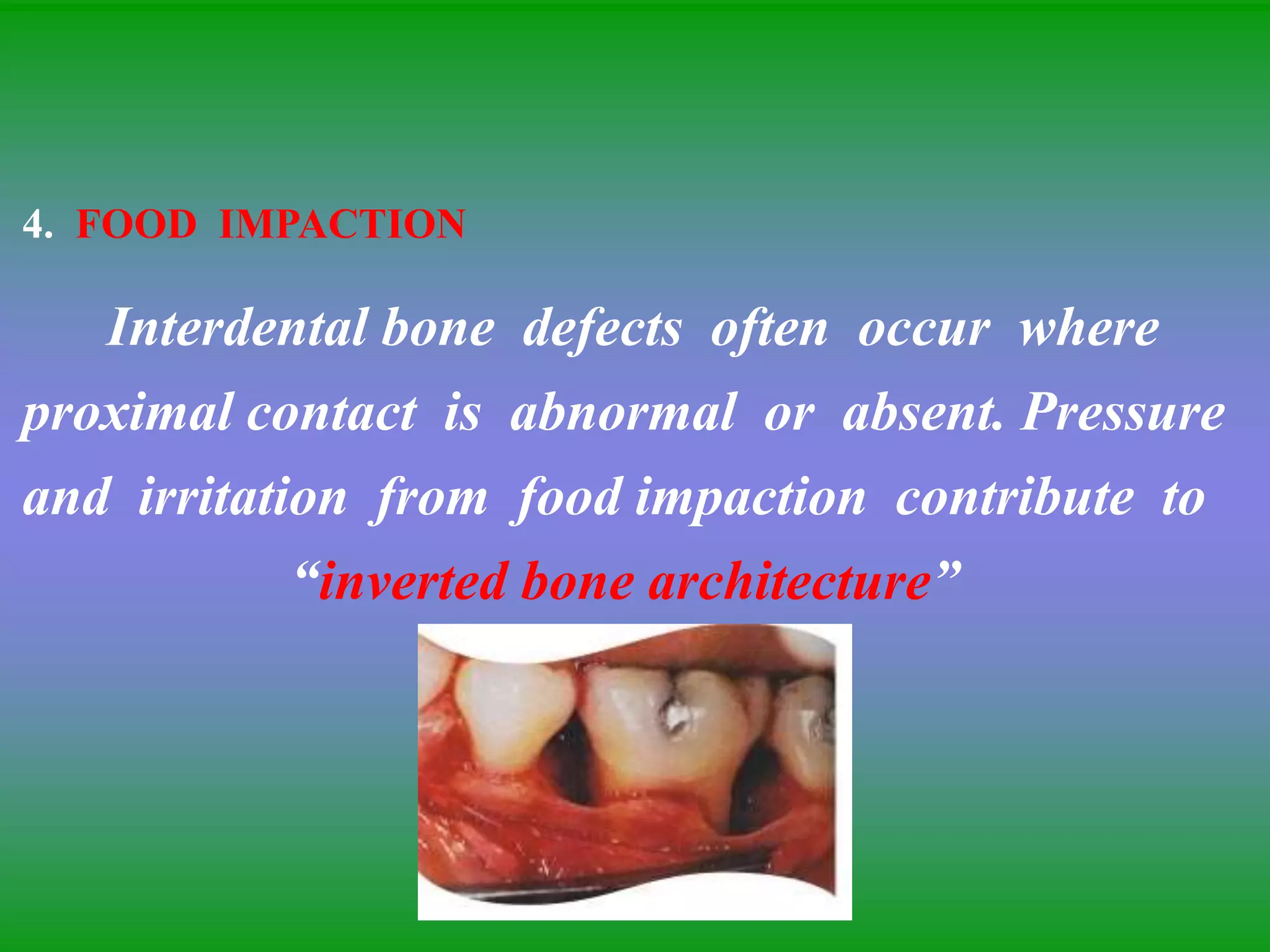 4. FOOD IMPACTION
Interdental bone defects often occur where
proximal contact is abnormal or absent. Pressure
and irritation from food impaction contribute to
“inverted bone architecture”
 