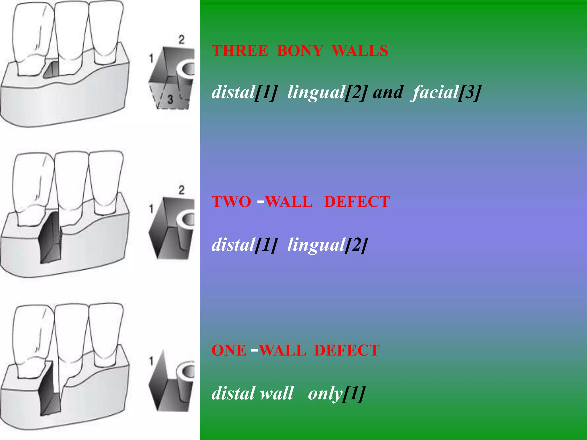 THREE BONY WALLS
distal[1] lingual[2] and facial[3]
TWO -WALL DEFECT
distal[1] lingual[2]
ONE -WALL DEFECT
distal wall only[1]
 