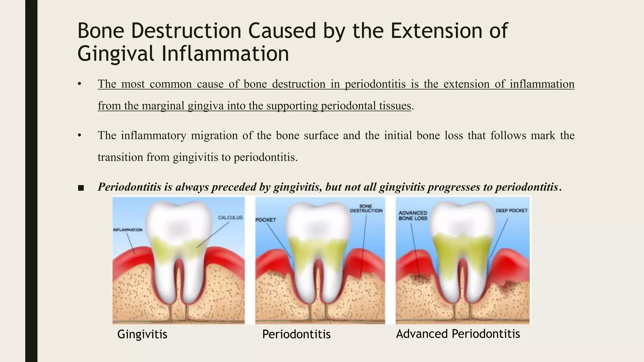 Bone Destruction Caused by the Extension of
Gingival Inflammation
• The most common cause of bone destruction in periodontitis is the extension of inflammation
from the marginal gingiva into the supporting periodontal tissues.
• The inflammatory migration of the bone surface and the initial bone loss that follows mark the
transition from gingivitis to periodontitis.
■ Periodontitis is always preceded by gingivitis, but not all gingivitis progresses to periodontitis.
Gingivitis Periodontitis Advanced Periodontitis
 