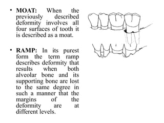 Moat Form Bone loss and patterns of bone loss | PPT