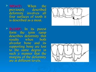 Moat Form bone loss and patterns of bone loss.ppt in | PPT