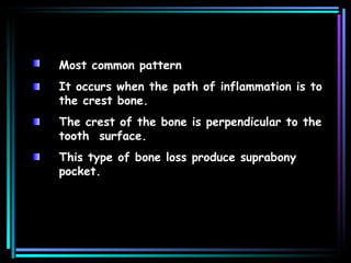 Most common pattern It occurs when the path of inflammation is to the crest bone. The crest of the bone is perpendicular to the tooth  surface. This type of bone loss produce suprabony pocket. 