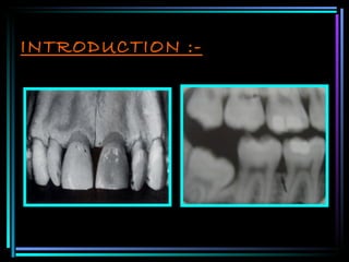 INTRODUCTION :- 