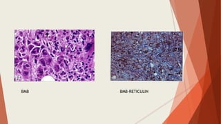 BMB BMB-RETICULIN
 