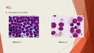 ALL
 Sub types of ALL(FAB)-
 L1- small homogenous blasts
 L2- large heterogenous blasts
 L3 – large homogenous blasts
BMA ALL L1 BMA ALL L2
 