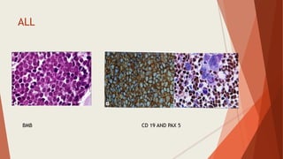 ALL
BMB CD 19 AND PAX 5
 