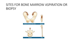 SITES FOR BONE MARROW ASPIRATION OR
BIOPSY
 