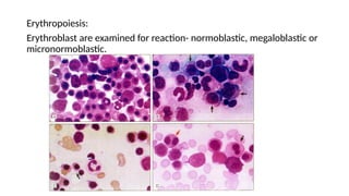 Erythropoiesis:
Erythroblast are examined for reaction- normoblastic, megaloblastic or
micronormoblastic.
 