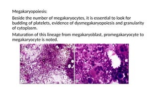 Megakaryopoiesis:
Beside the number of megakaryocytes, it is essential to look for
budding of platelets, evidence of dysmegakaryopoiesis and granularity
of cytoplasm.
Maturation of this lineage from megakaryoblast, promegakaryocyte to
megakaryocyte is noted.
 