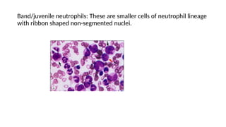 Band/juvenile neutrophils: These are smaller cells of neutrophil lineage
with ribbon shaped non-segmented nuclei.
 