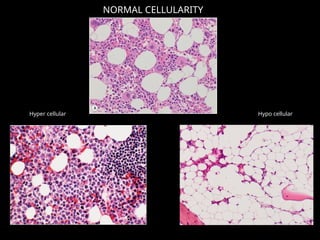 bonemarrow-4-180106181202.pptx bjhasgadg | PPTX